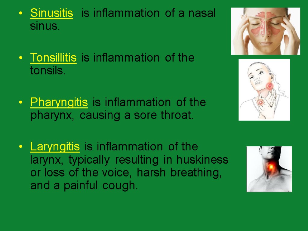 Sinusitis is inflammation of a nasal sinus. Tonsillitis is inflammation of the tonsils. Pharyngitis